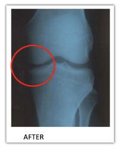 xray of joint