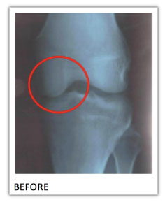 xray of joint