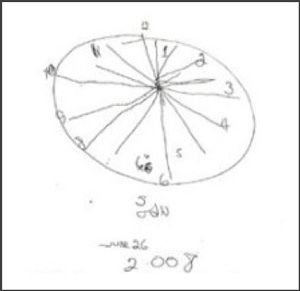 Drawing of a clock by an Alzheimer patient after 37 days of treatment