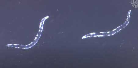 worms filmed under microscope