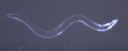 worms filmed under microscope